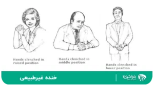 لبخند غیرطبیعی